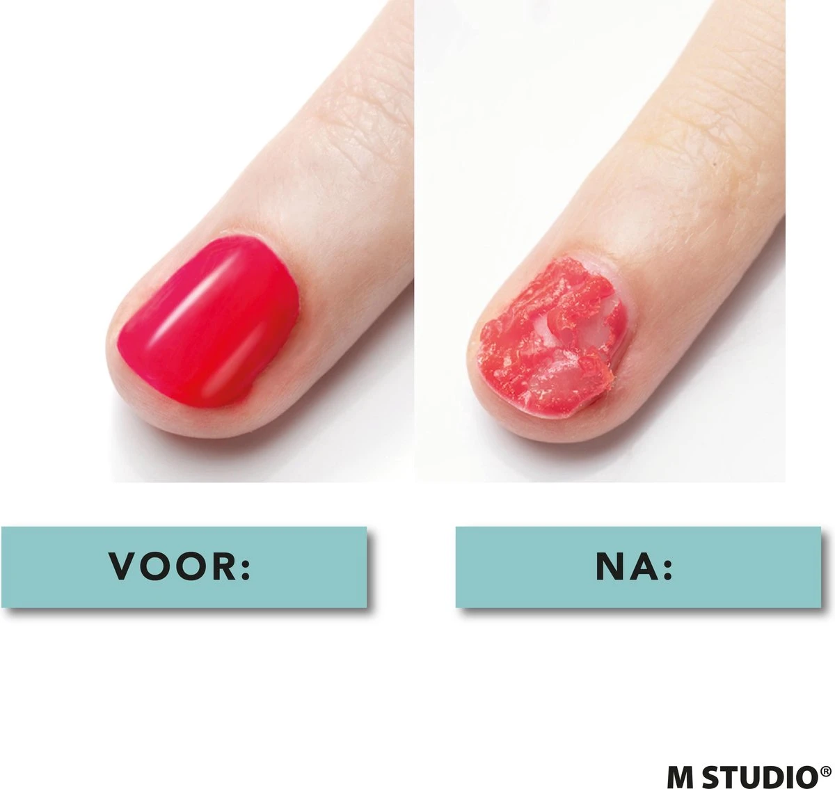 Rosalind Gellak Remover - 15ml - Met Nagelvijl En Bokkenpootje - Afbeelding 4